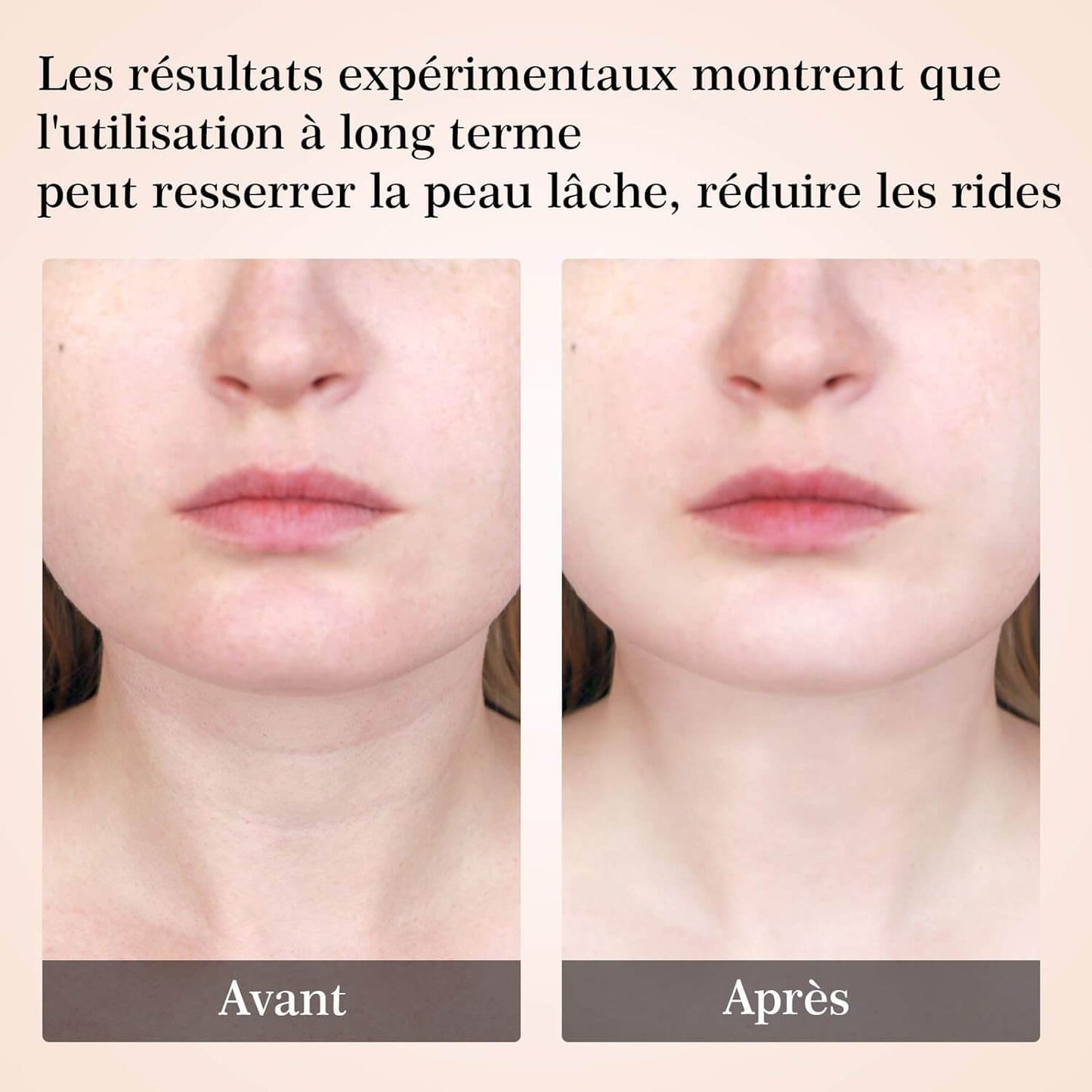 SculptVisage Cosladalle ™